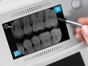 digital x-rays at Drummoyne Dental Practice