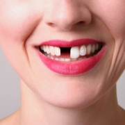 emergency dentist service in drummoyne