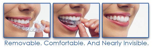 invisalign in drummoyne