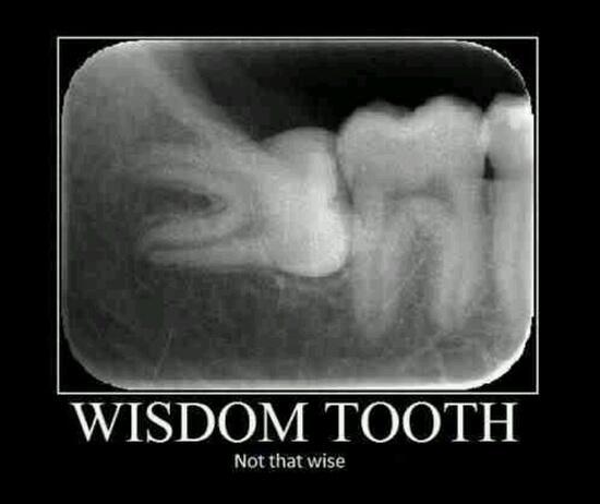 wisdom teeth removal drummoyne