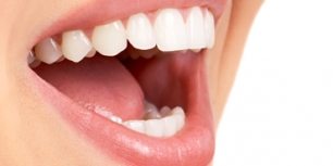 Fillings and Restorations - dentist Drummoyne